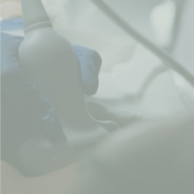 ecografia-ginecologica-2