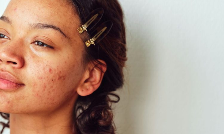 roberta-sant-anna-rQiTysg7a6U-unsplash